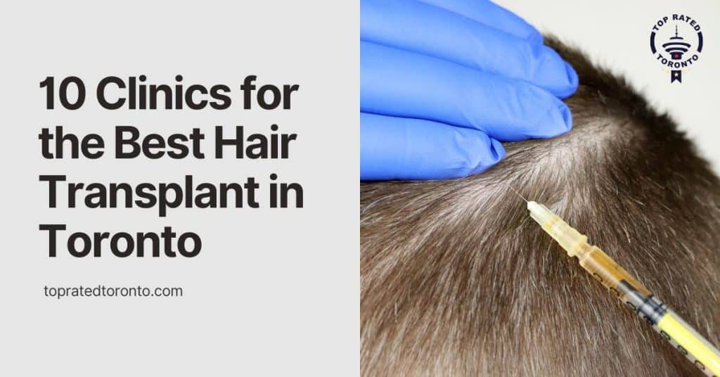 10 Clinics for the Best Hair Transplant in Toronto [January 2023]